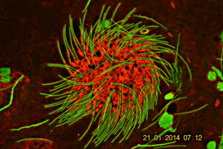 Spermi in lombricus che hanno ceduto proteine al citoforo - A.A.